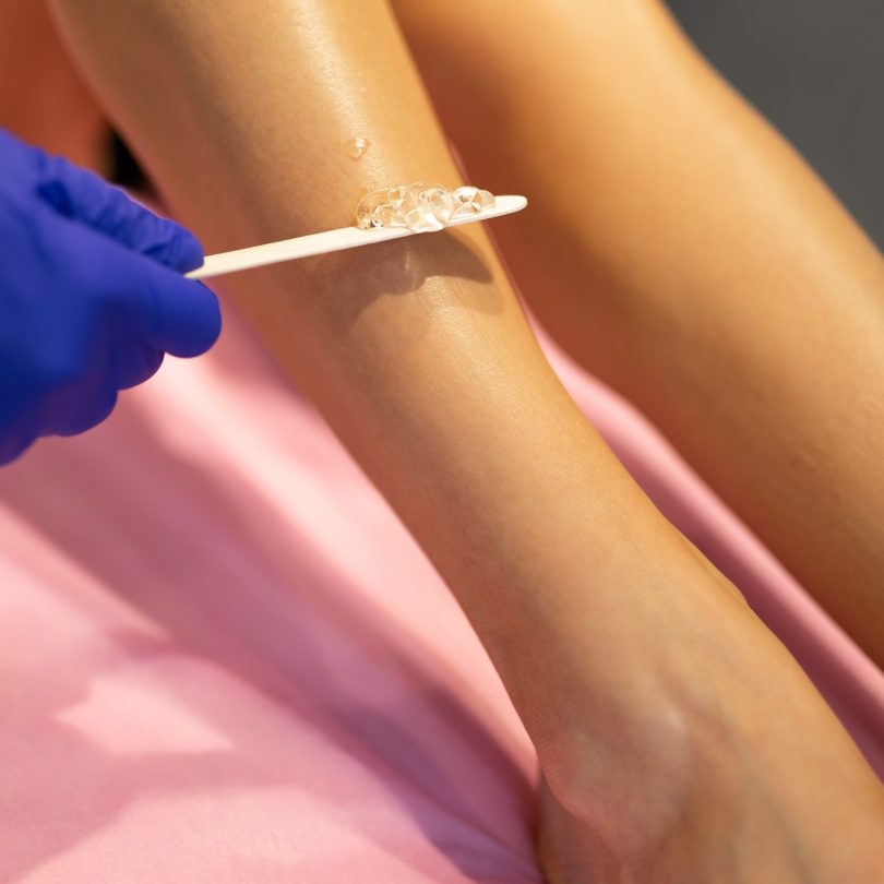 Beautician applies laser depilation gel to the patient's legs
